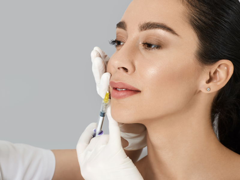 filler labbra naturale